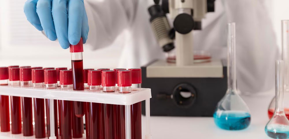 blood tests