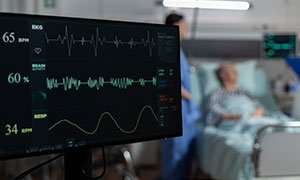 ecg