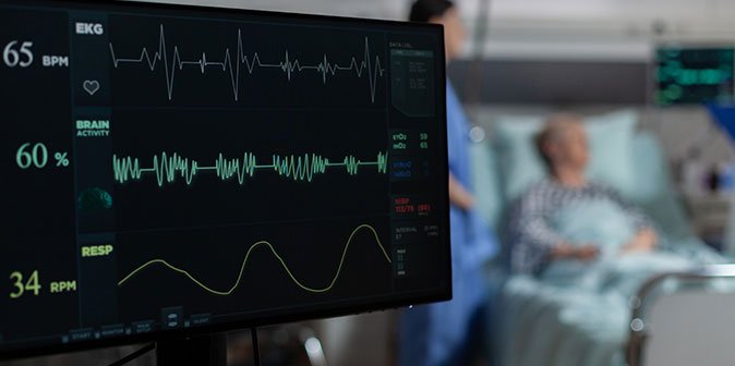 ecg