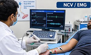 ncv